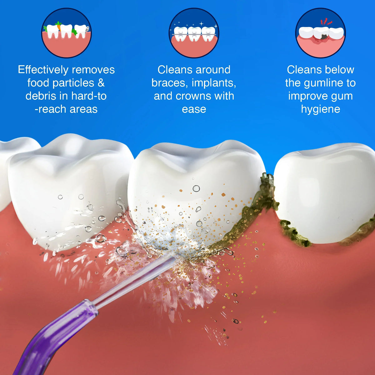Puntas de hilo dental de repuesto para el irrigador dental Deep Clean Dental Water Flosser 2.0 XL