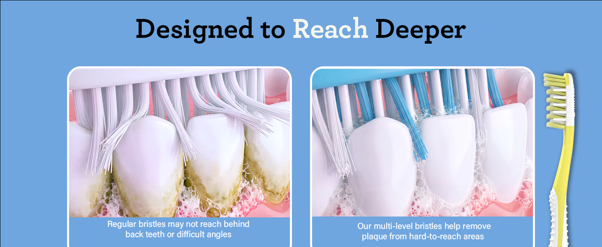 Designed to reach deeper — regular bristles may miss behind back teeth, while multi-level bristles help remove plaque from hard-to-reach areas